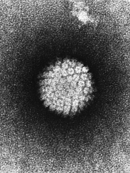By Author: Unknown photographer/artist Source: Laboratory of Tumor Virus Biology (NIH-Visuals Online# AV-8610-3067) [Public domain], via Wikimedia Commons