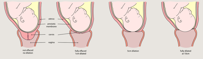 Kühlschrank labor contractions in back